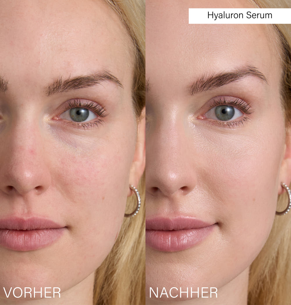 Hyaluron Serum