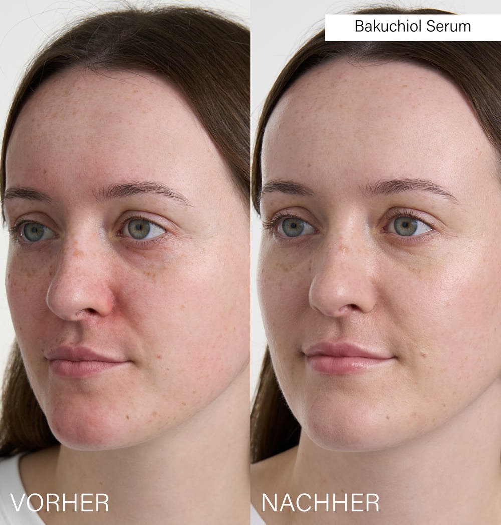 Bakuchiol Serum