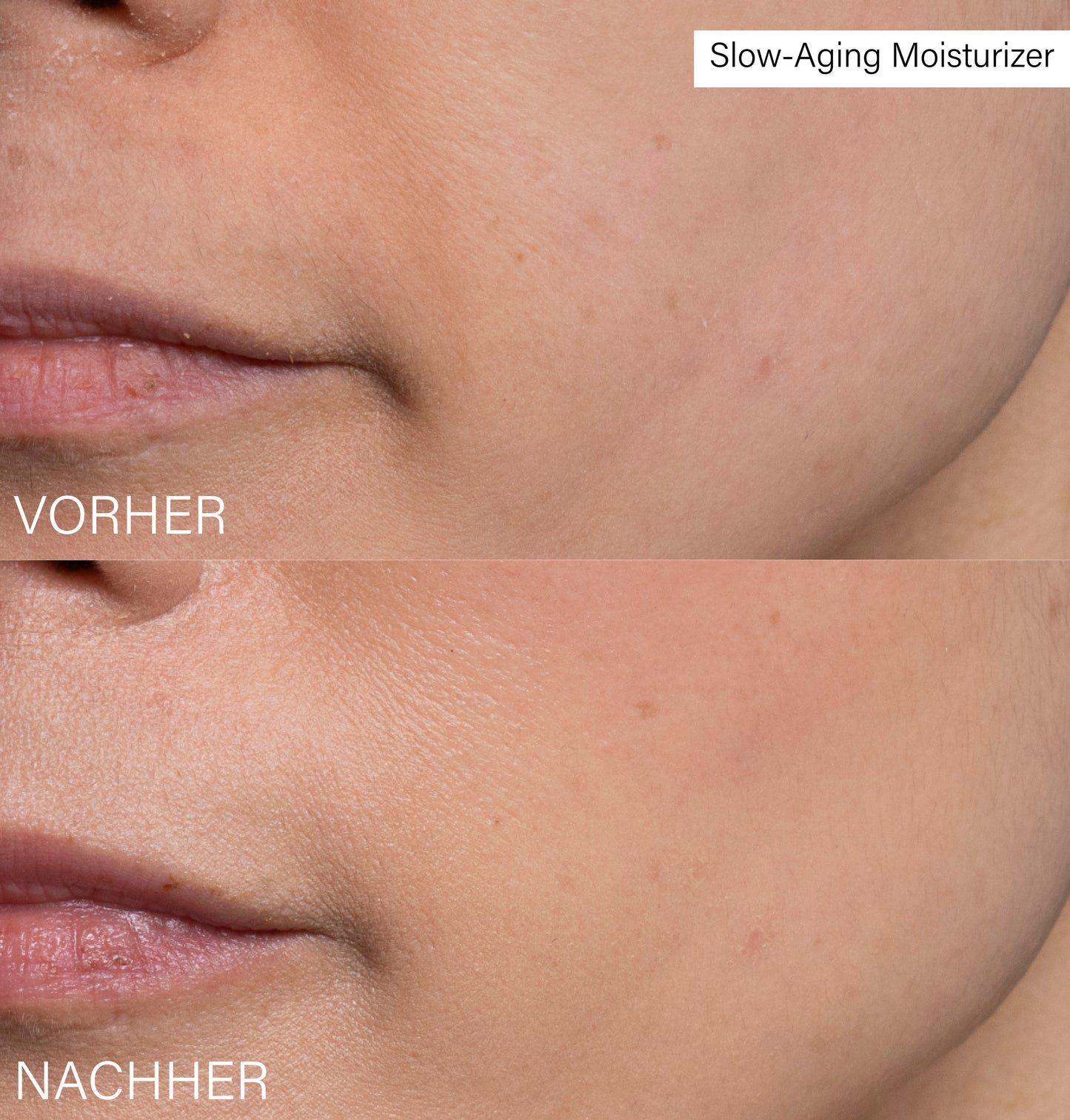 Slow-Aging Moisturizer | with Rosehip and Hyaluron