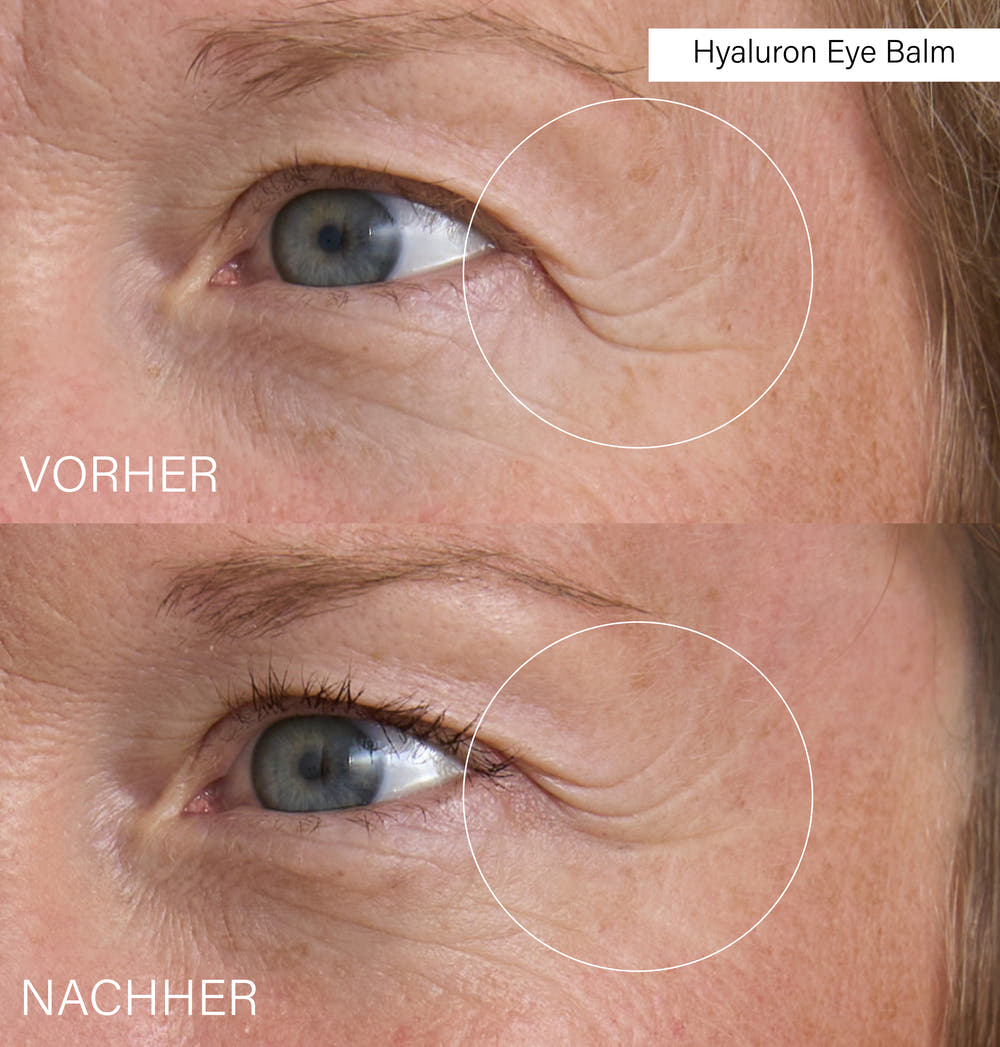 Hyaluron Eye Balm