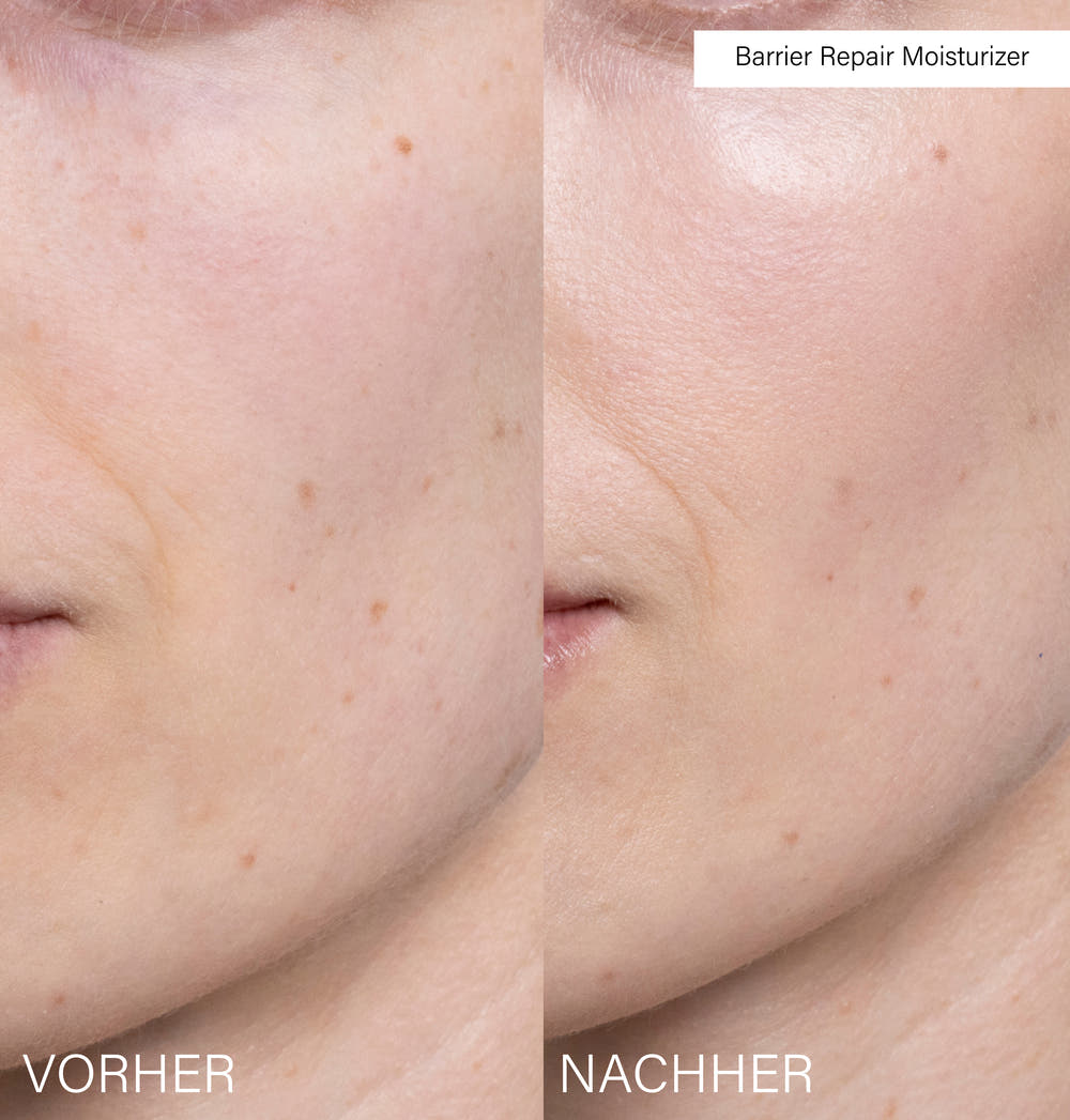 Barrier Repair Moisturizer