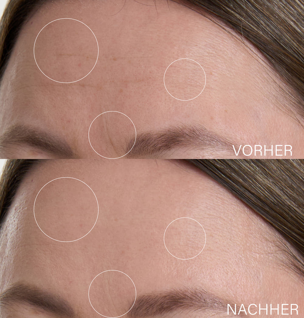 Botanical Lifting Effect Serum