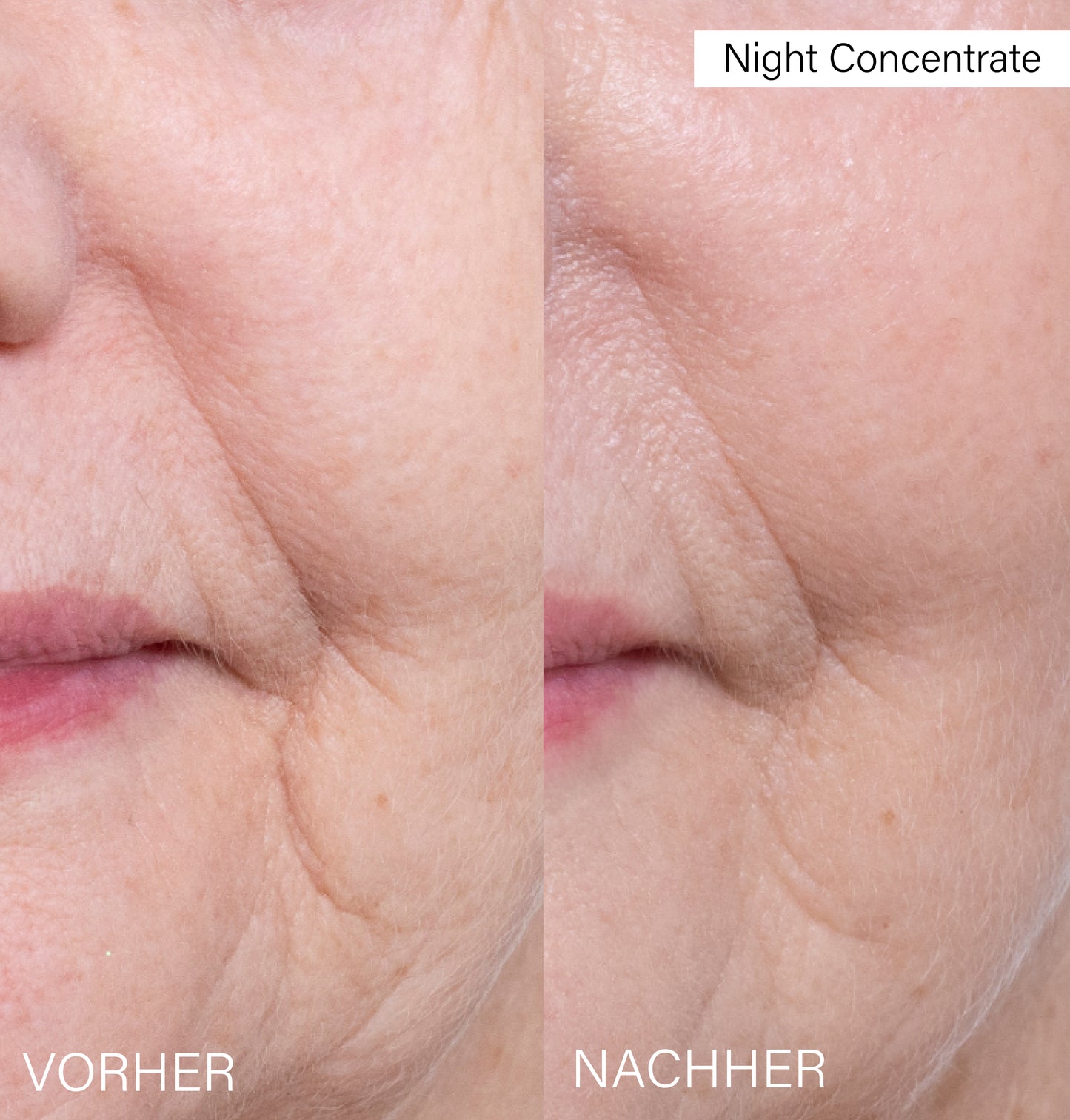 Night Concentrate | with Althaea Rosea Stem Cells