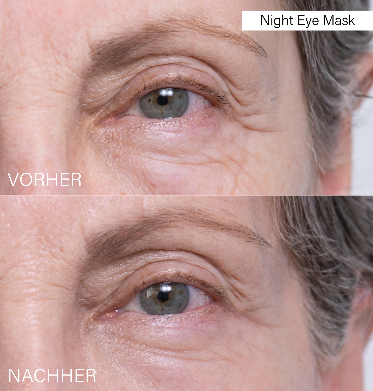 Night Eye Mask | Stem Cells Intense Treatment (TBD)