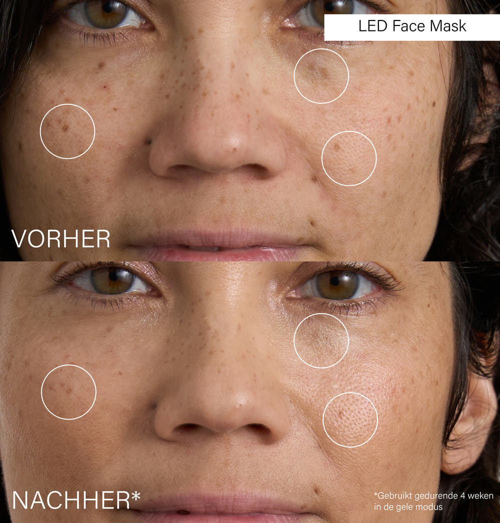 LED Face Mask