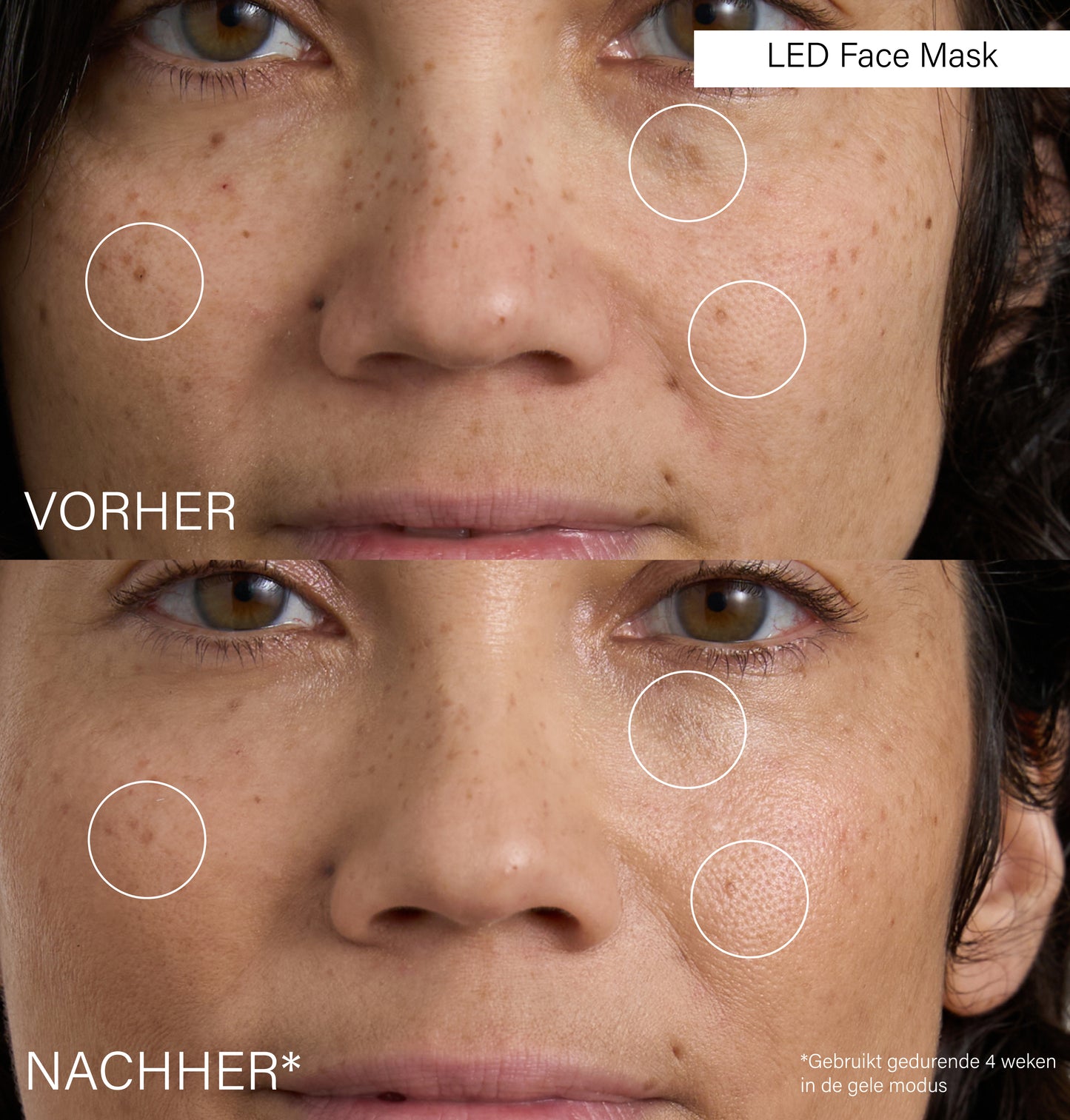 LED Face Mask