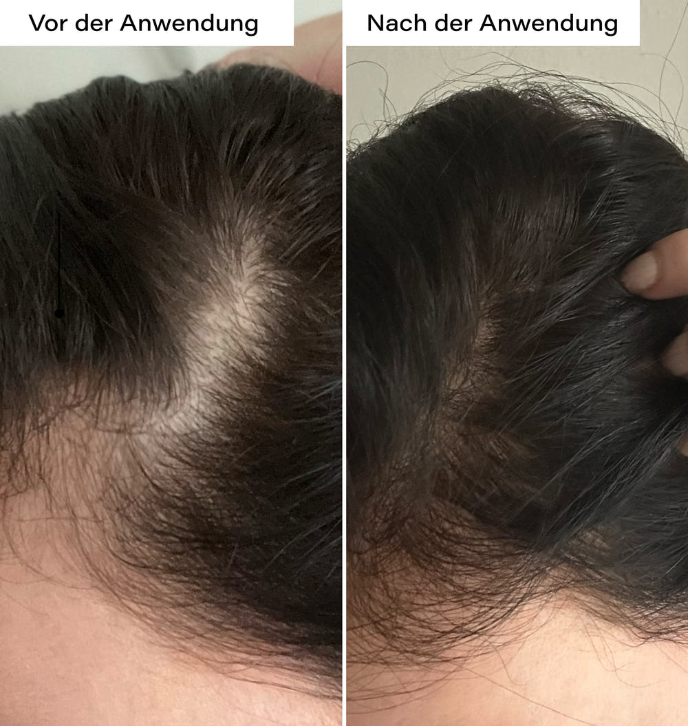 Hair Growth Serum