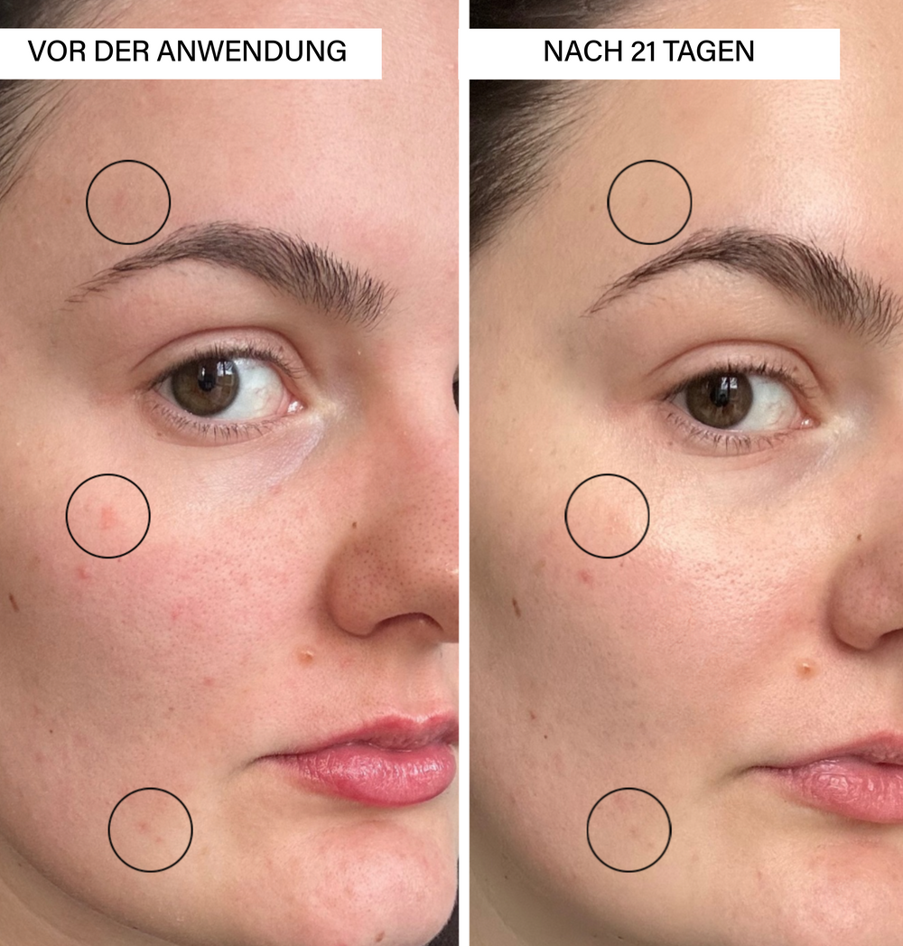 Brightening Serum