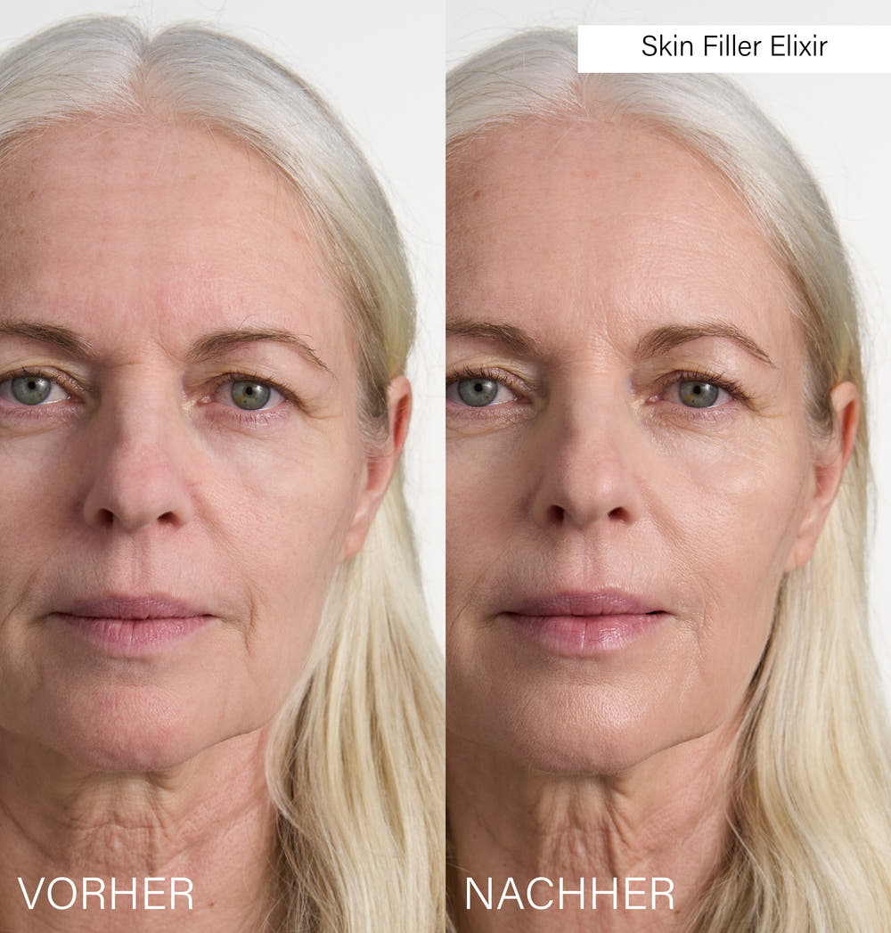 Skin Filler Elixir