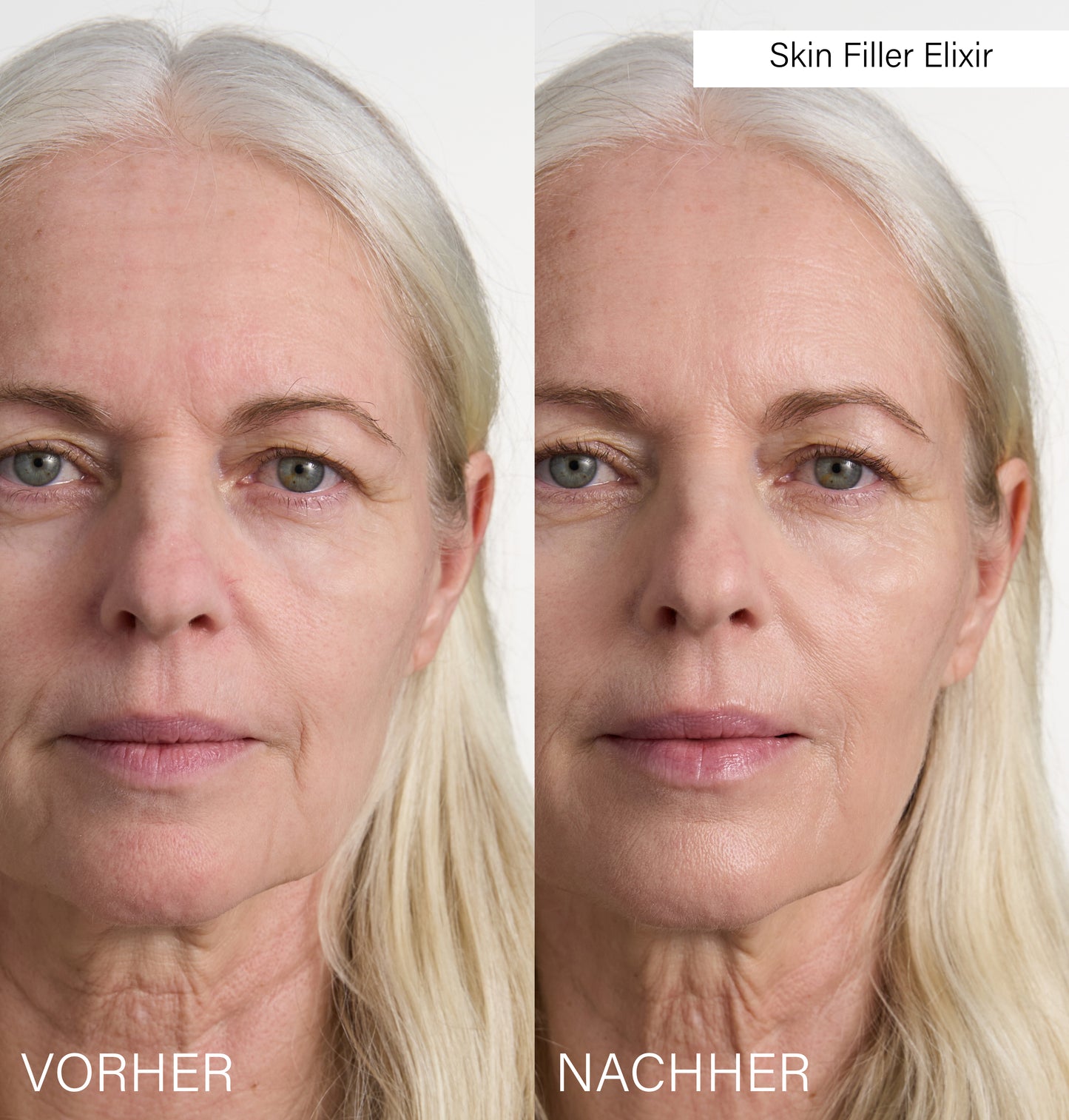Skin Filler Elixir | Instant Lifting & Hydration