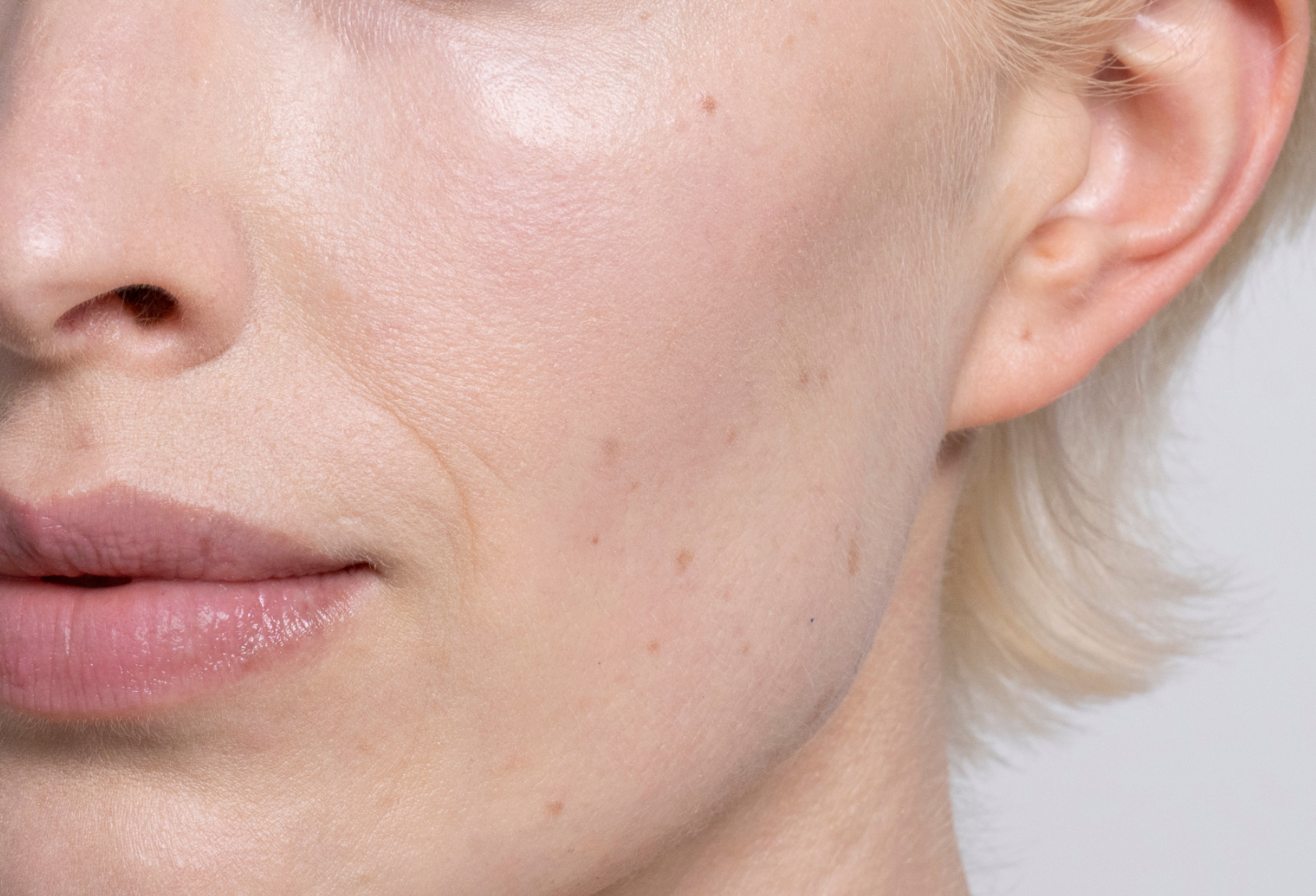 Barrier Repair Moisturizer
