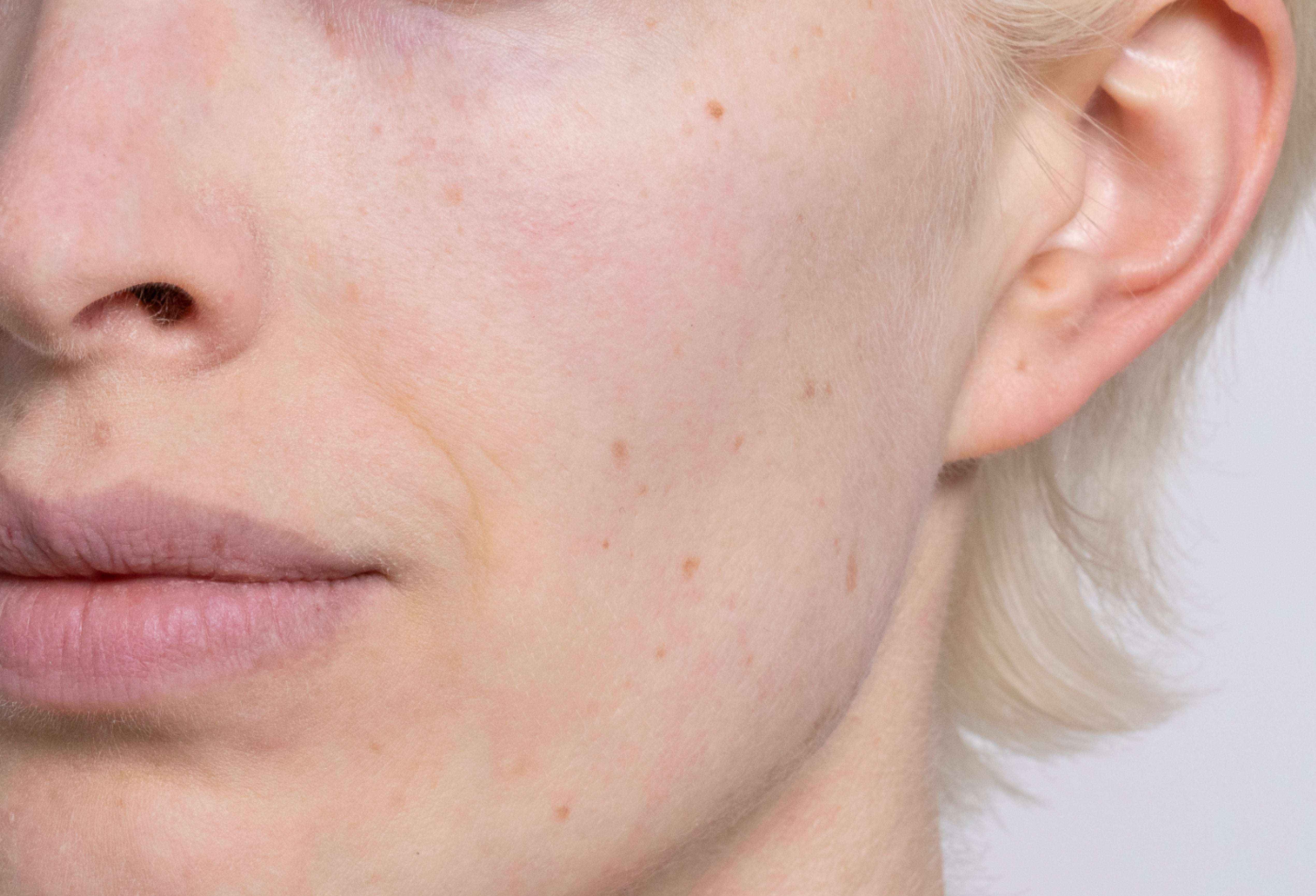 Barrier Repair Moisturizer