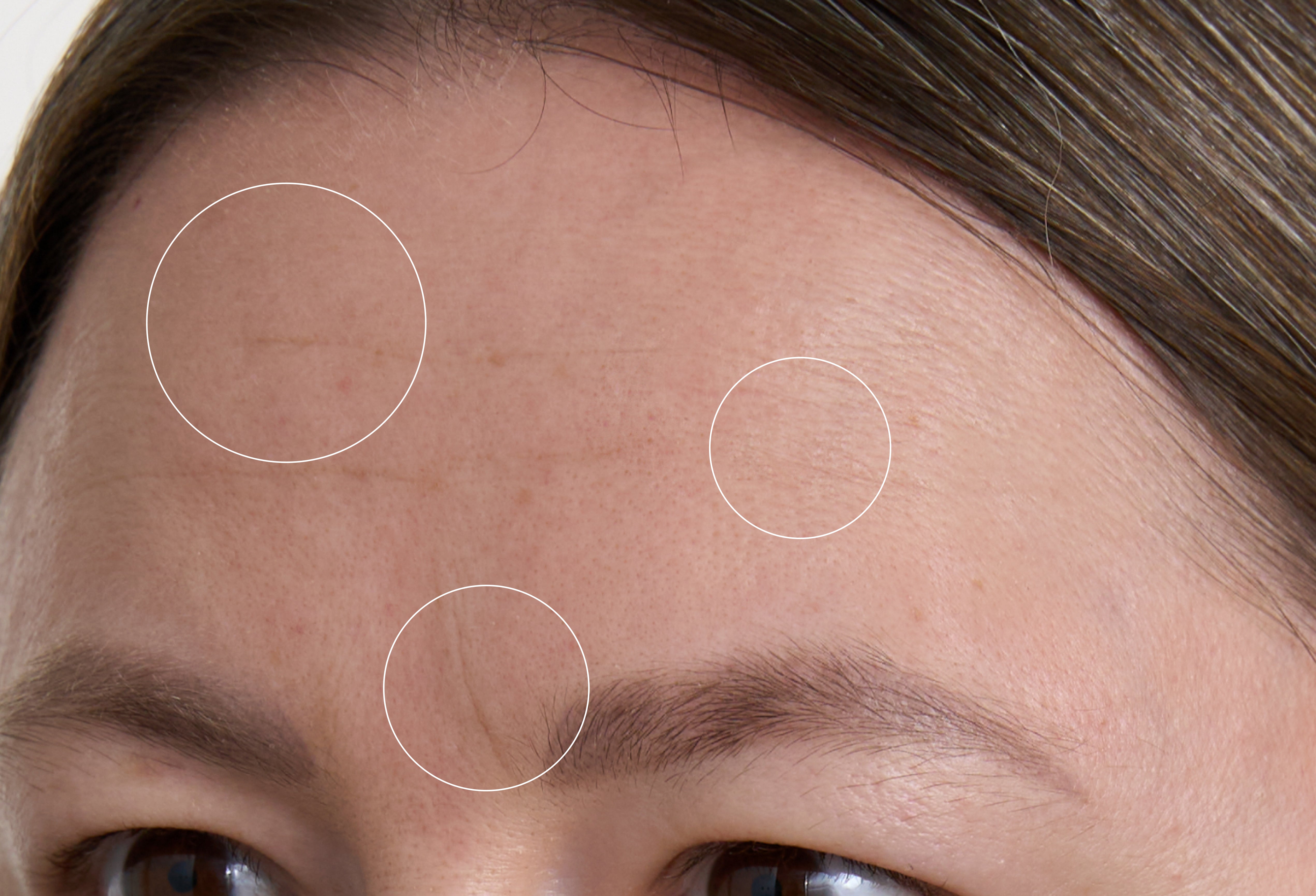 Botanical Lifting Effect Serum