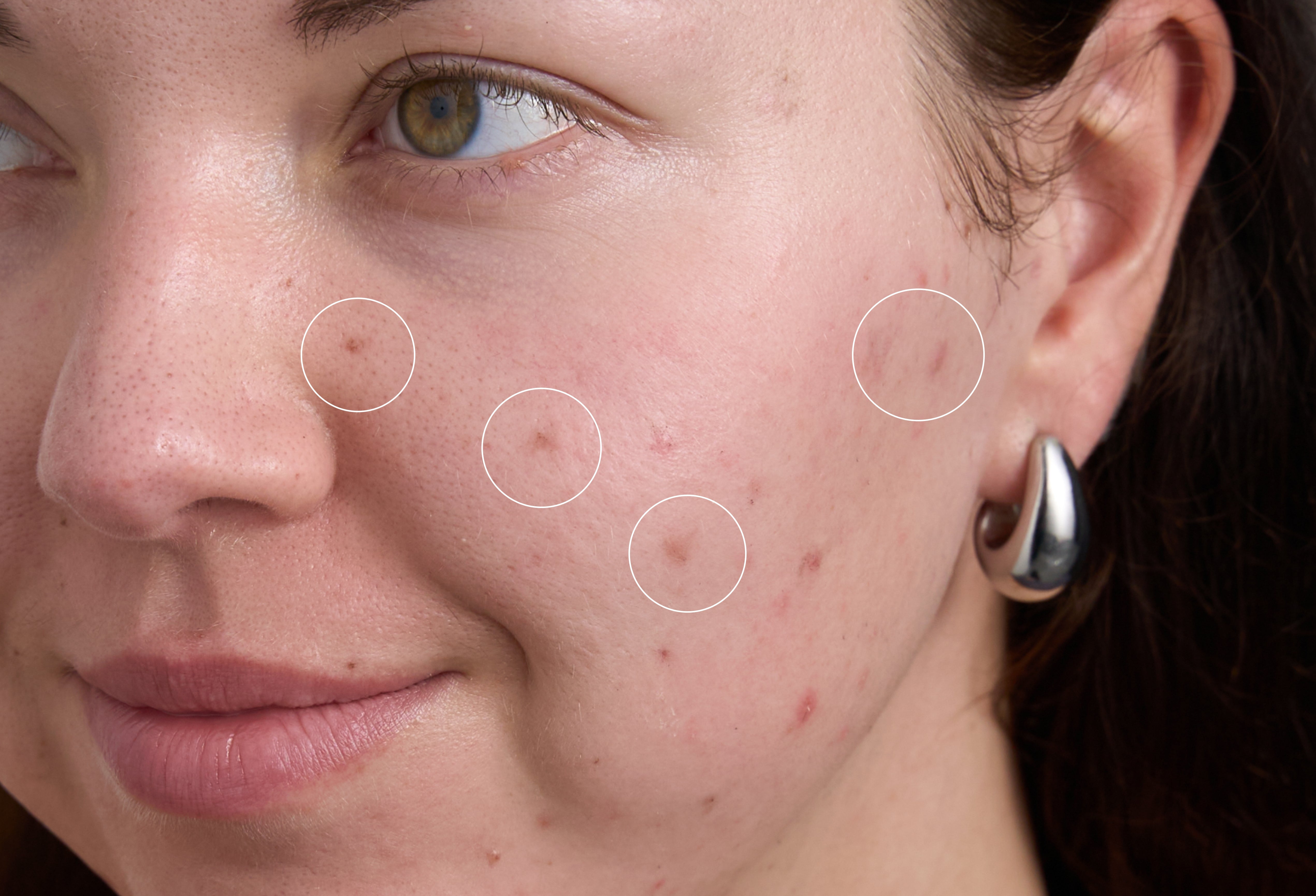 Brightening Serum
