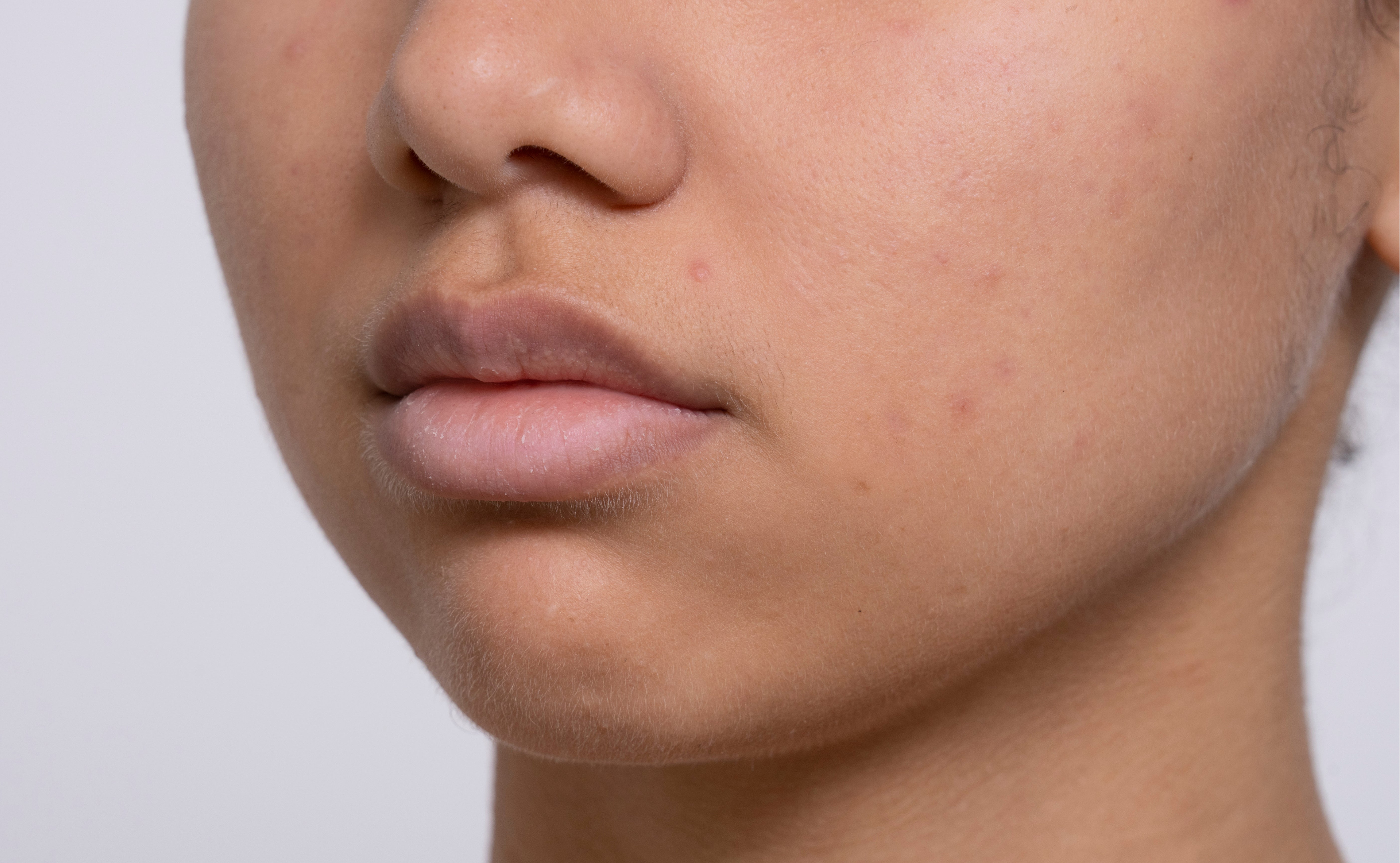 Niacinamide Serum
