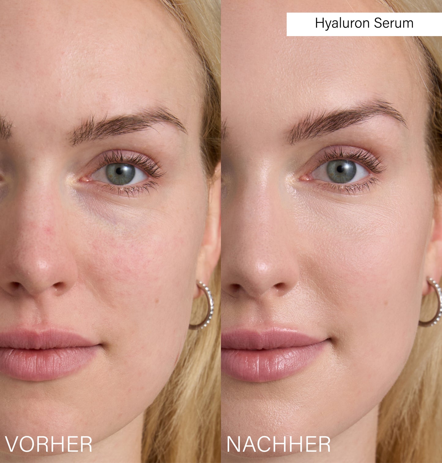 Slow Aging Set