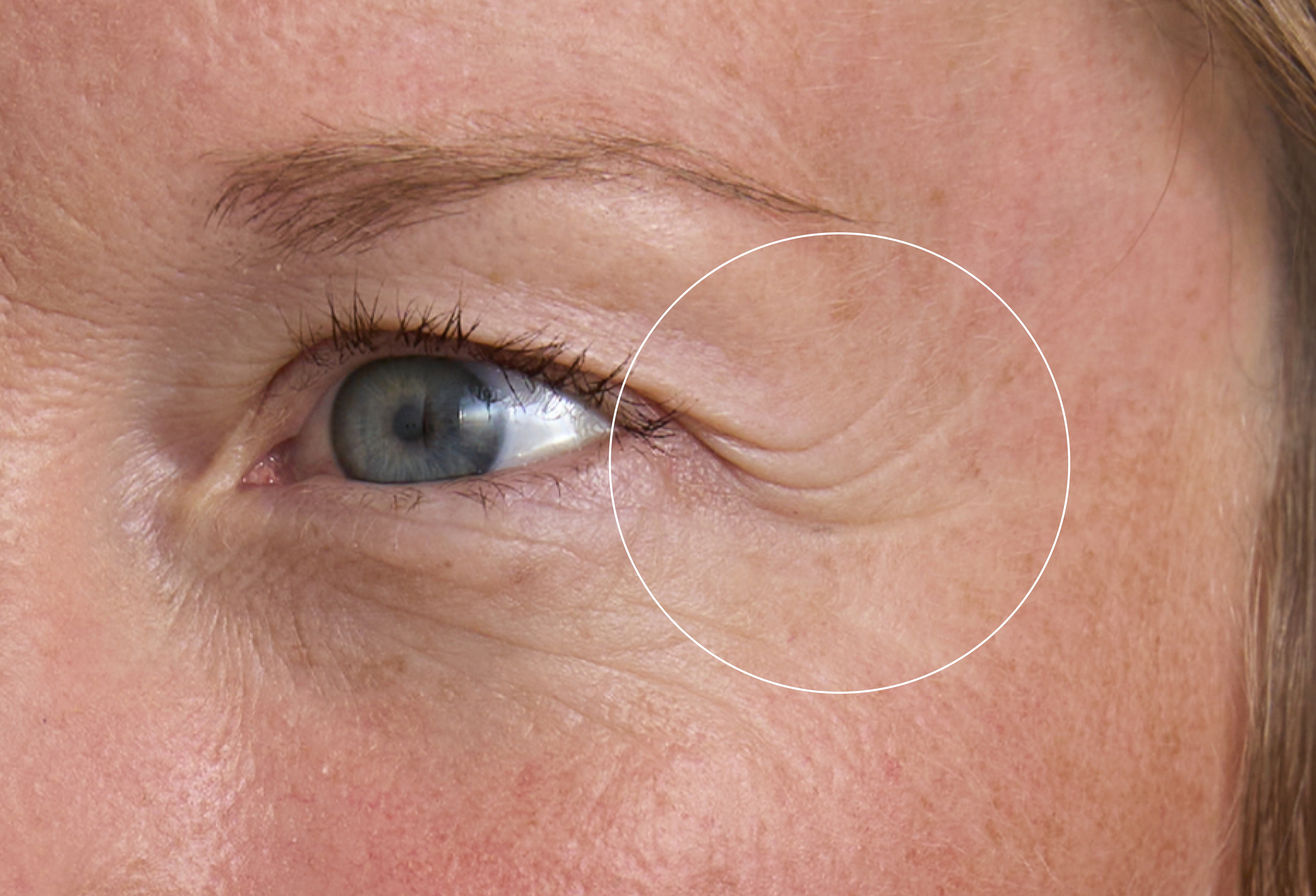 Hyaluron Eye Balm