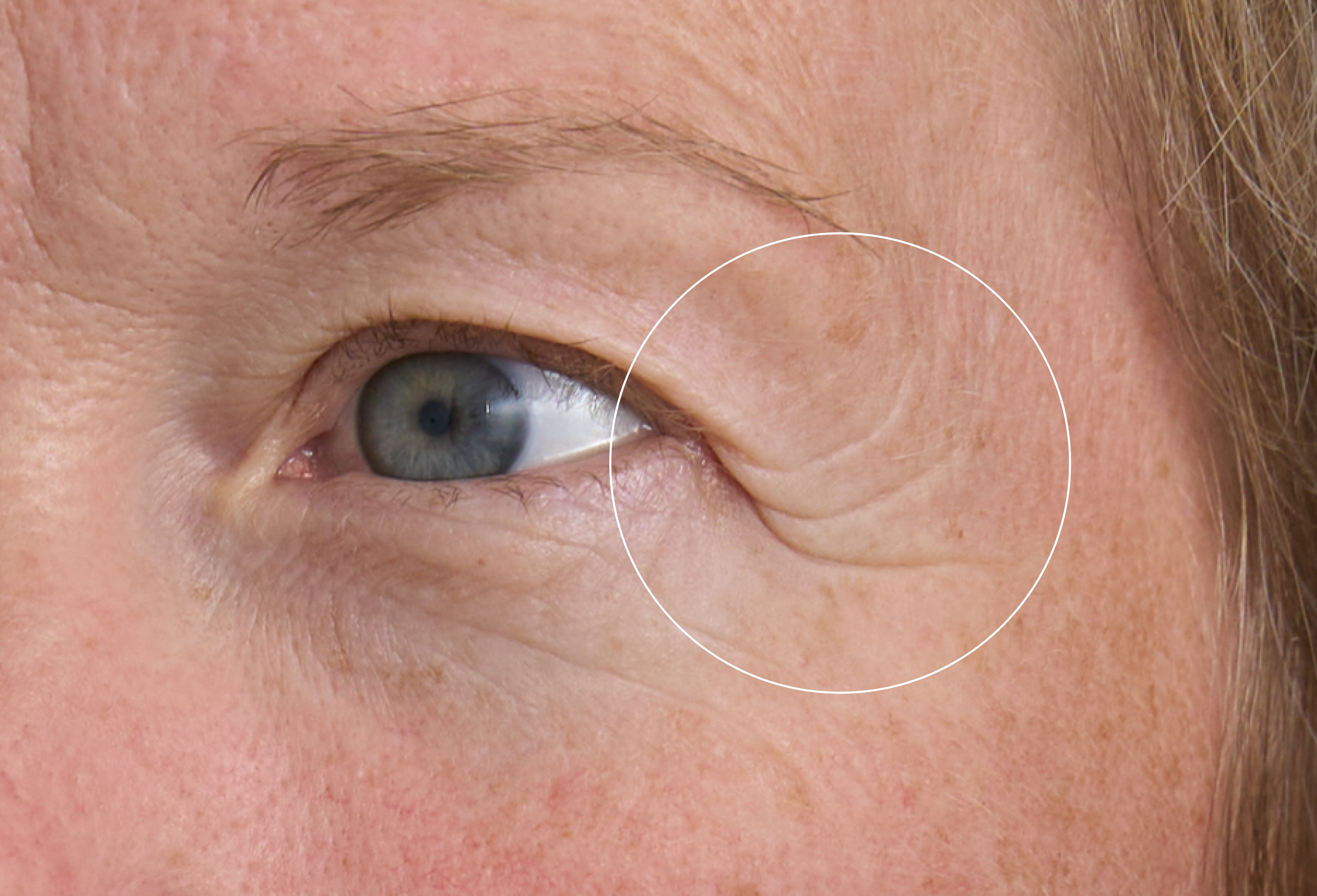 Hyaluron Eye Balm
