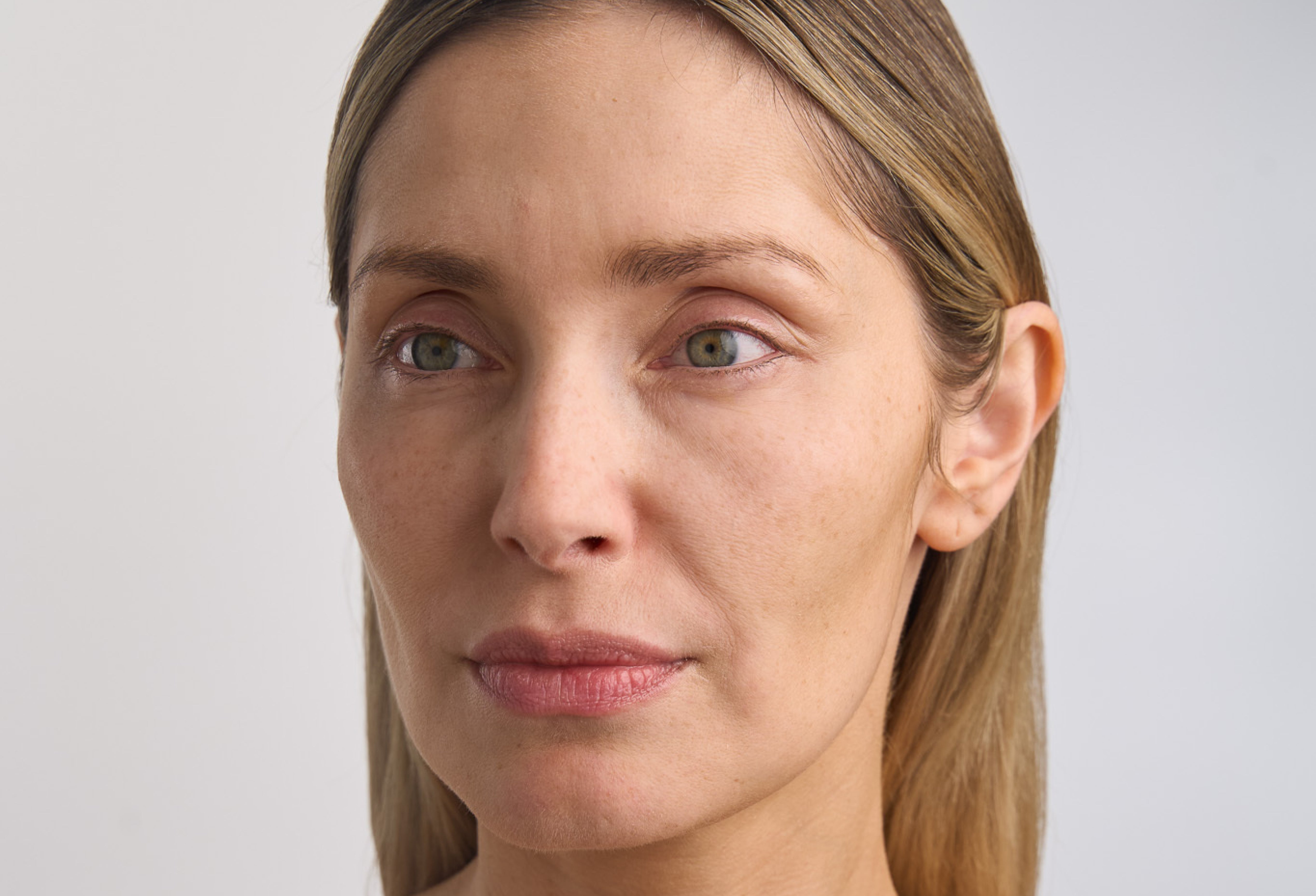 Microneedling Effect Treatment