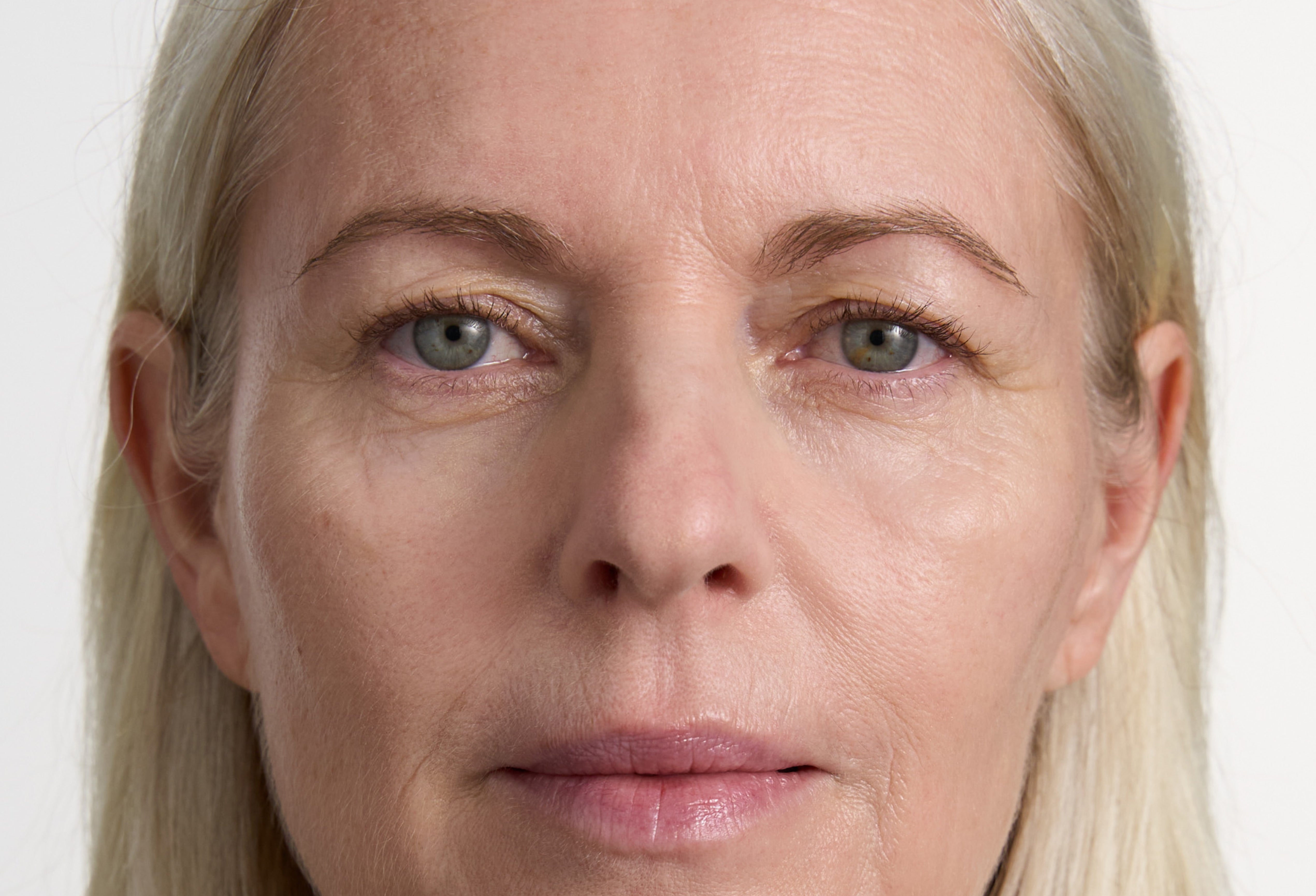 Skin Filler Elixir