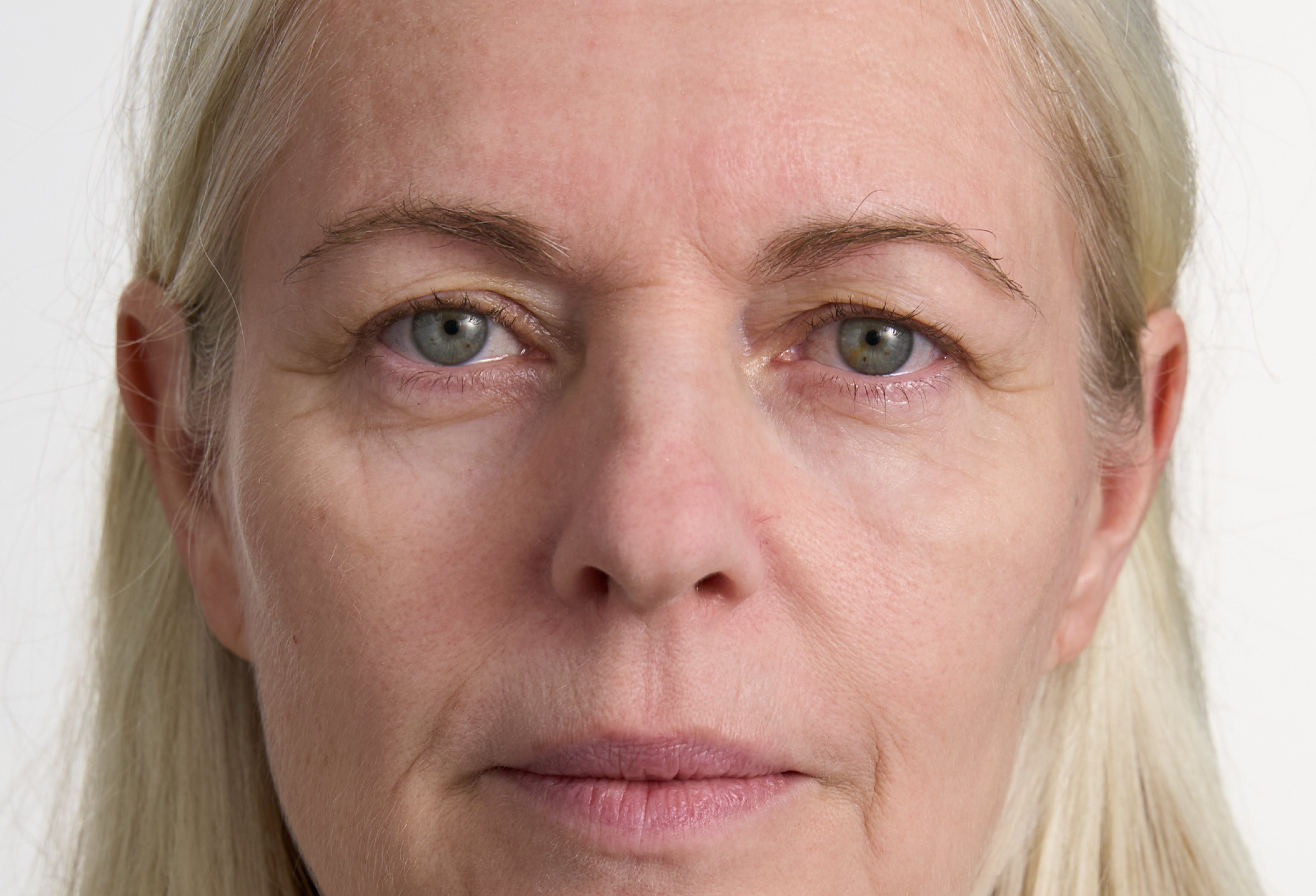 Skin Filler Elixir