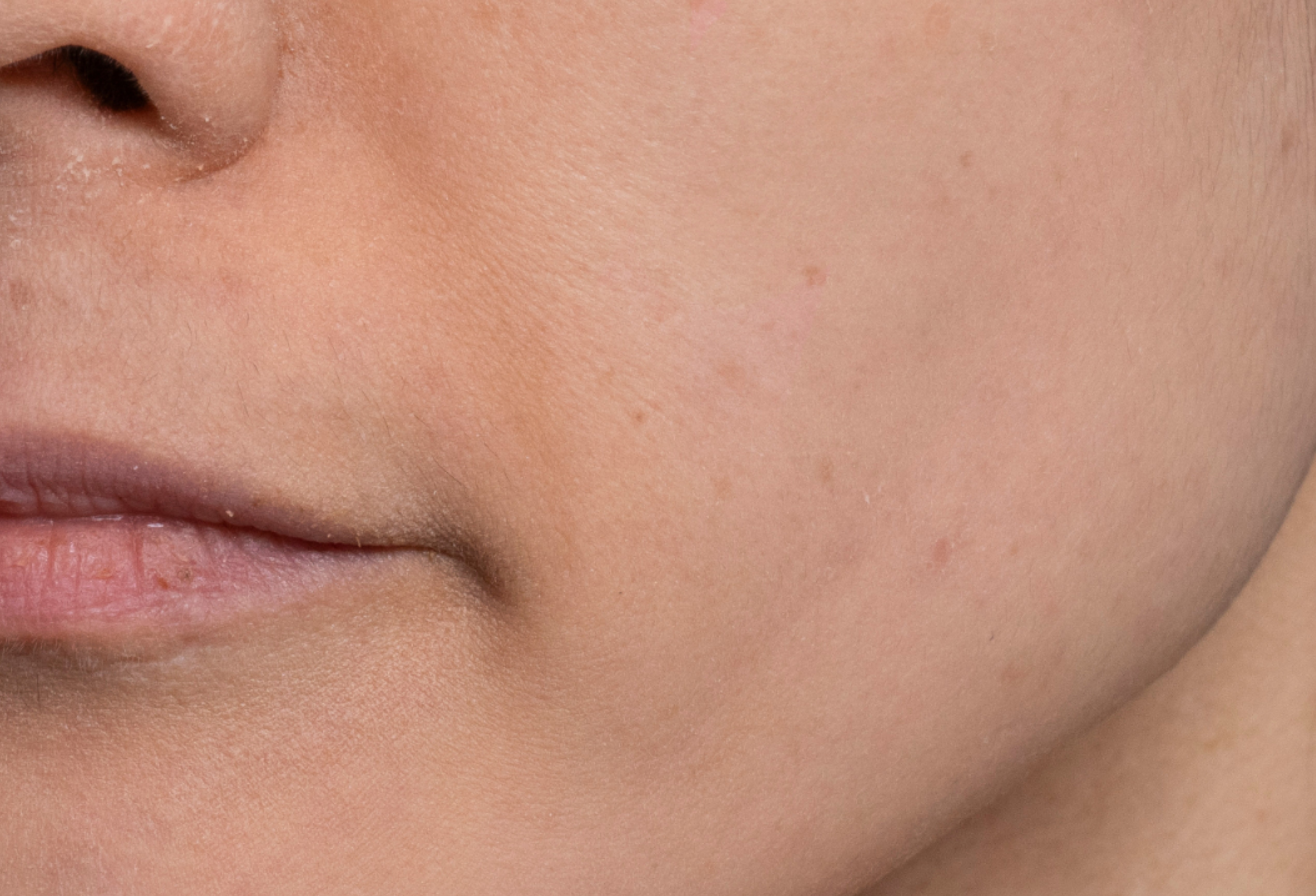 Slow-Aging Moisturizer