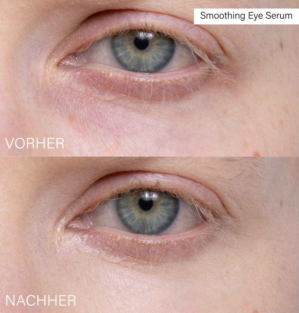 Slow Aging Set